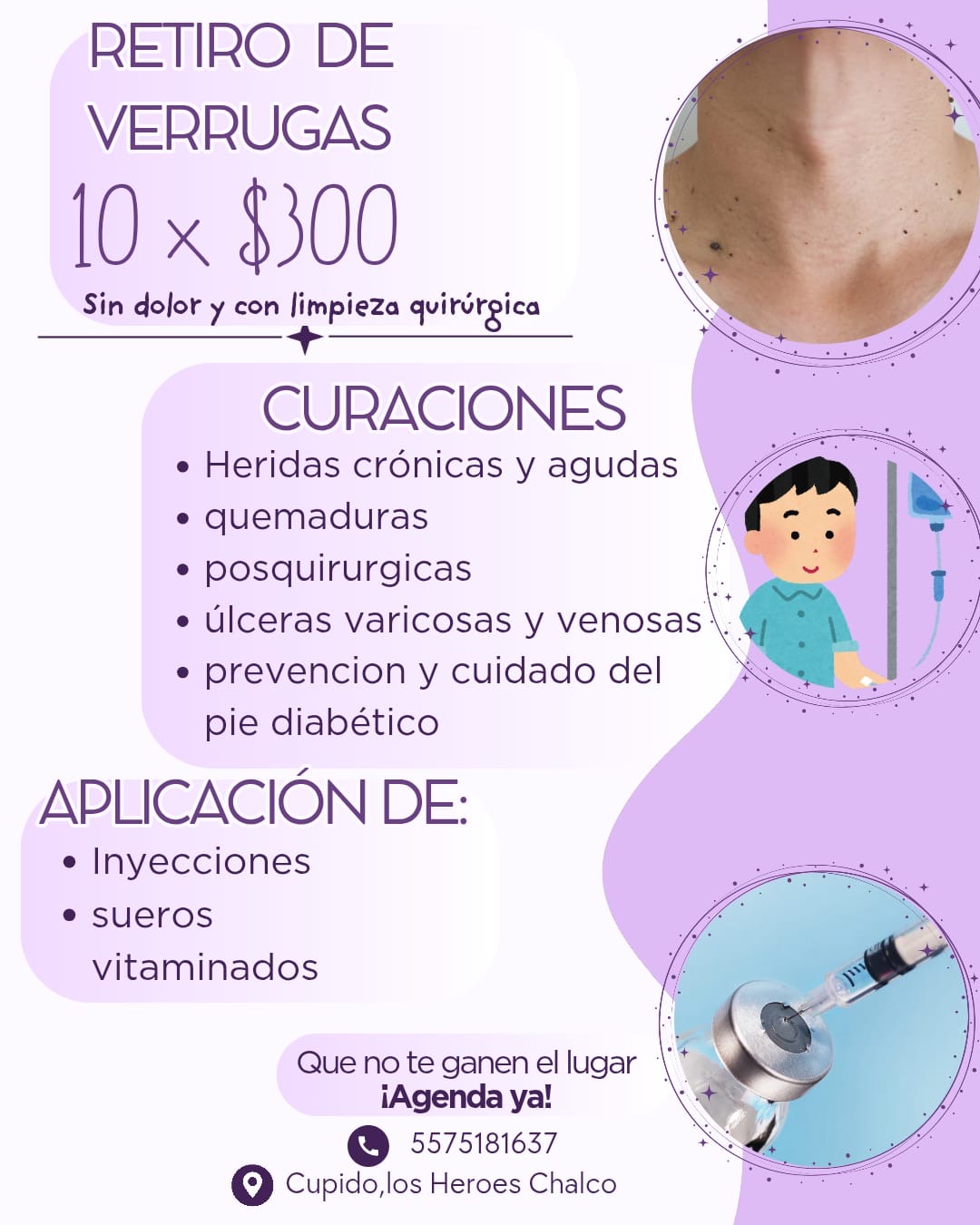 Promoción de retiro de verrugas y curaciones